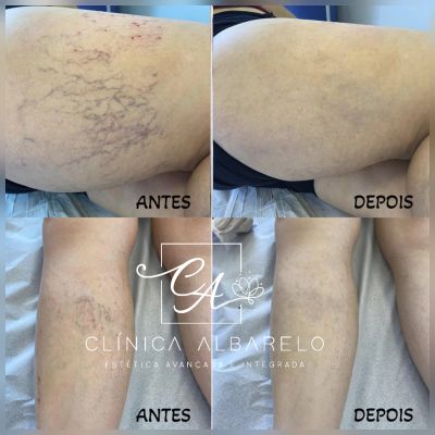 Clínica de Estética Albarelo foto 4