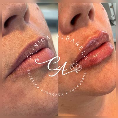 Clínica de Estética Albarelo foto 5