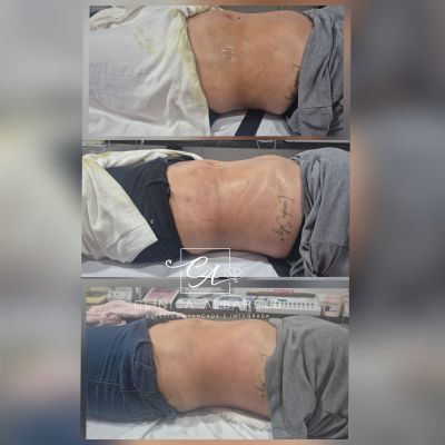 Clínica de Estética Albarelo foto 3